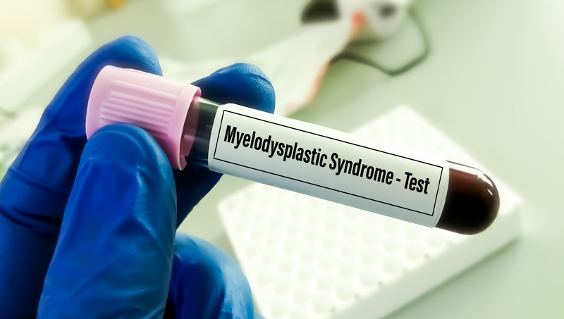 Myelodysplastic Syndrome Treatment in India