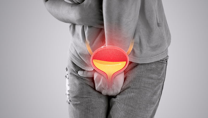 Prostate Cancer Treatment in India