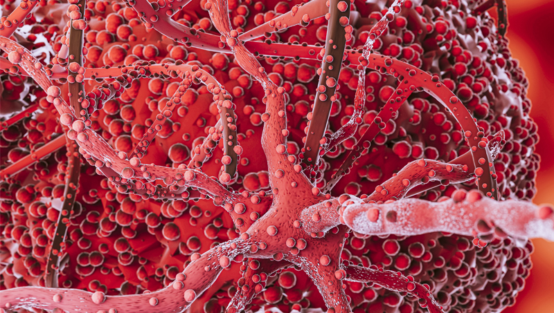 Best Sickle Cell Anemia Treatment In India