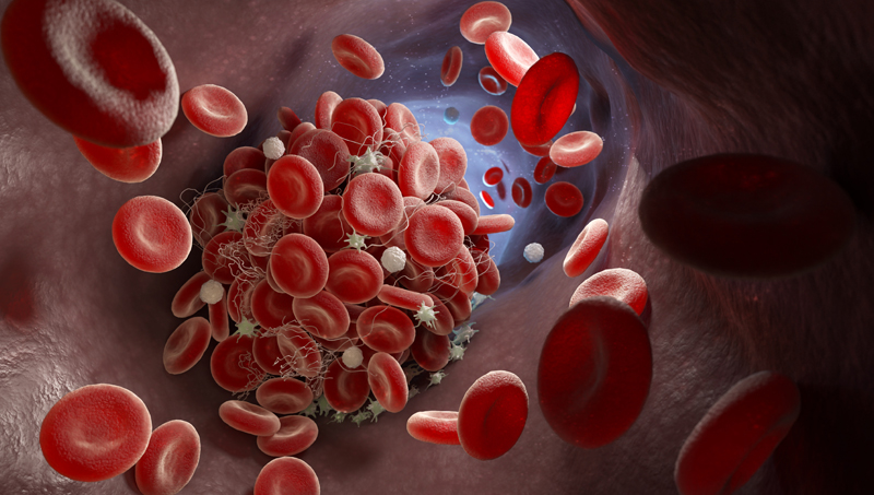 What is Leukemia And How To Recover From It?